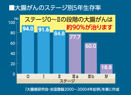「早期発見」で治る確率の高い「大腸がん」