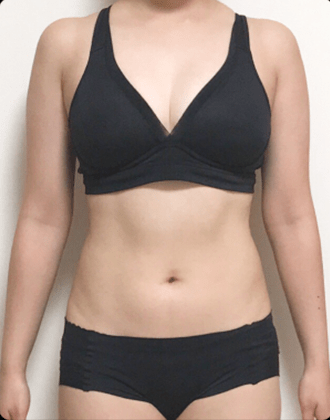 AFTER（3ヶ月後）