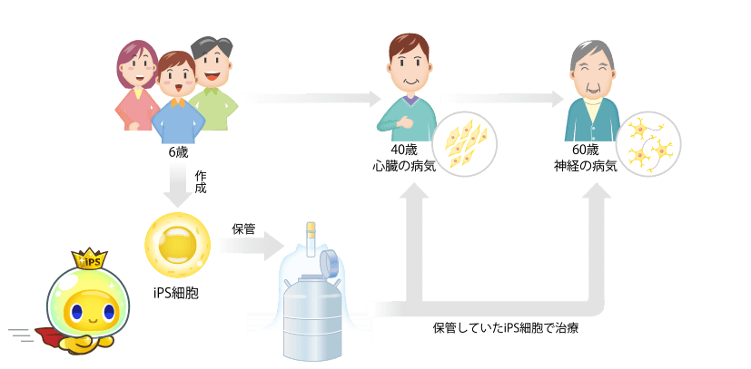 パーソナルiPSとは